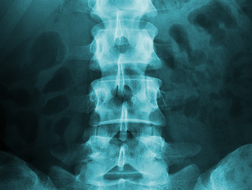 Back X-ray